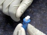 Activists Hope Grim DC HIV/AIDS Brings Attention to Problem