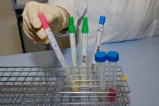Va.'s 2nd Swine Flu-Related Death Recorded in Arlington