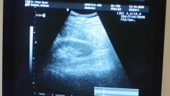Navigating the Changes of Pregnancy