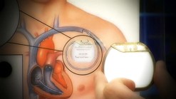 New Device Could Be Heart's