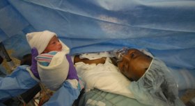 Quadruplets Born at Howard University Hospital