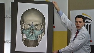 Landmark Face Transplant Is Most Comprehensive Yet
