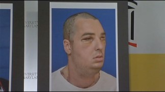 Va. Man Undergoes Full Face Transplant