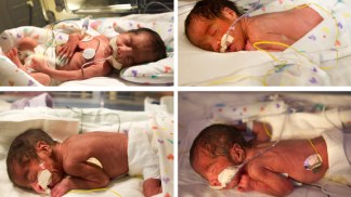 Twin Twins: Two Sets at Once