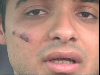 Nationalism May Have Caused Virginia Brawl