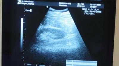 AM Read: McDonnell Hesitates on Ultrasounds