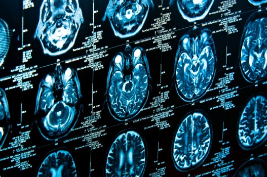 See Inside Einstein's Brain... Literally