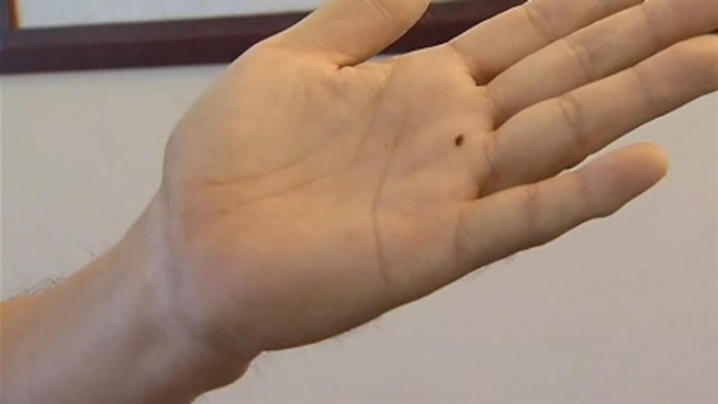 The latest on the battle to kill bed bugs in a Fairfax County, Va., apartment building. <a href=