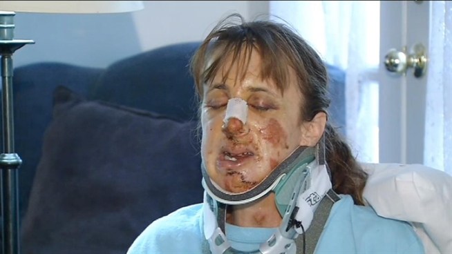 Jodi Grant, a Bethesda mother, was hit by a car on Massachusetts Avenue on Friday.  She is recovering from a fractured neck and back. Police are still searching for the driver.