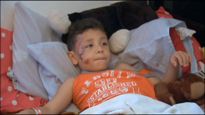 The father of a child hit by an SUV in reverse talks about being smashed into a garage door.