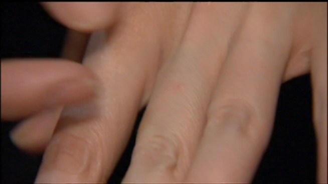 A woman says she was devastated after her $12,000 engagement ring, a family treasure, fell off on an escalator at the Dupont Circle station.