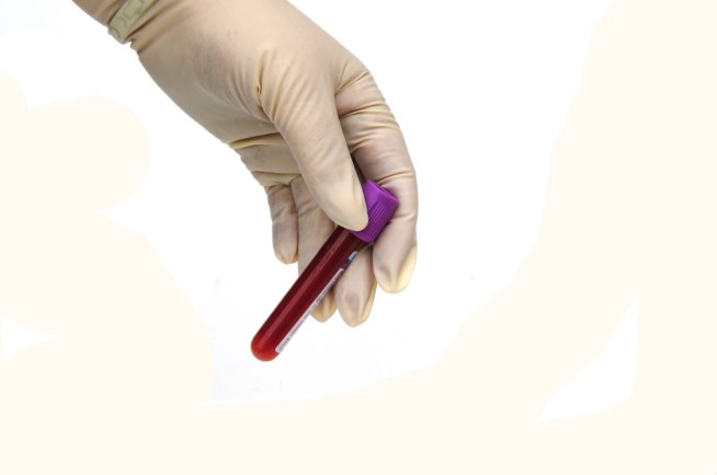 Army Stops Use of WoundStat