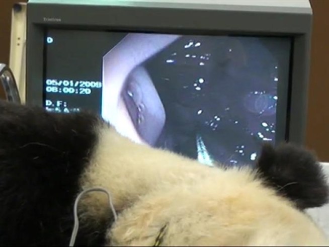 Loveable panda Tai Shan gets a routine exam ... and a colonoscopy.