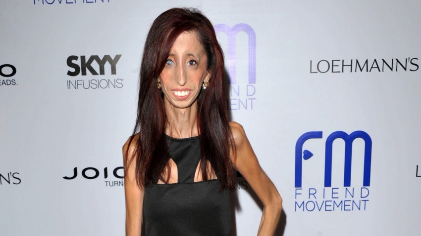 Film Lizzie Velasquez