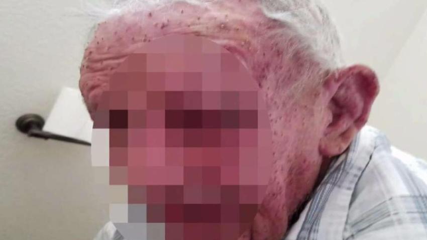 Bee_Attack_Leaves_77-Year-Old_Fighting_for_His_Life.jpg