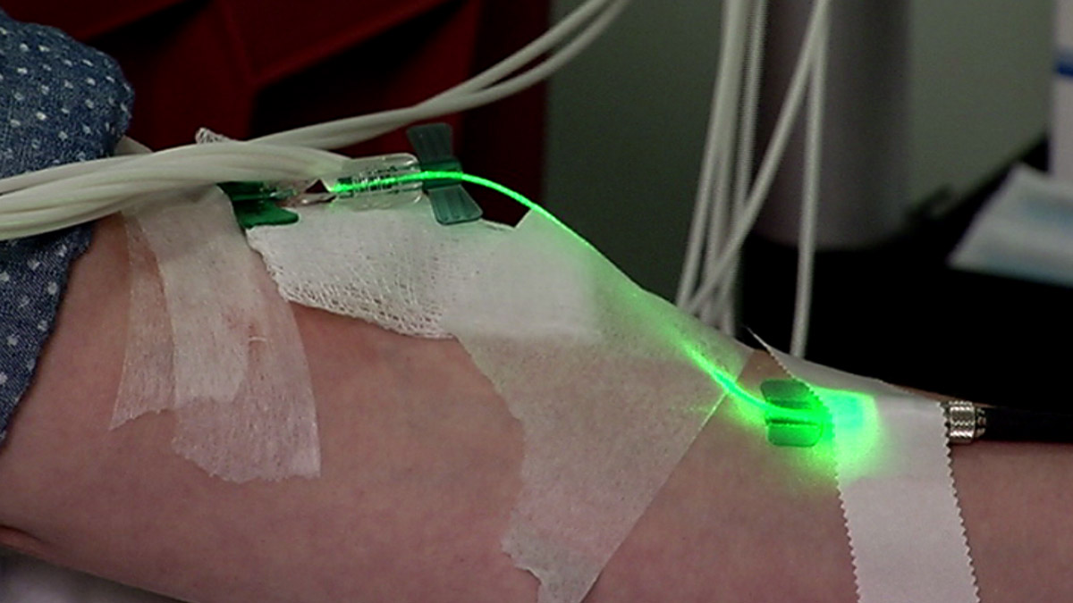 Intravenous Light Therapy Provides Relief for People With Lyme Disease NBC4 Washington