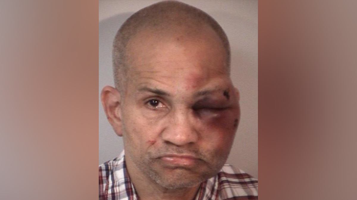 Man Accused of Molesting Children Beaten by Their Father, Police Say