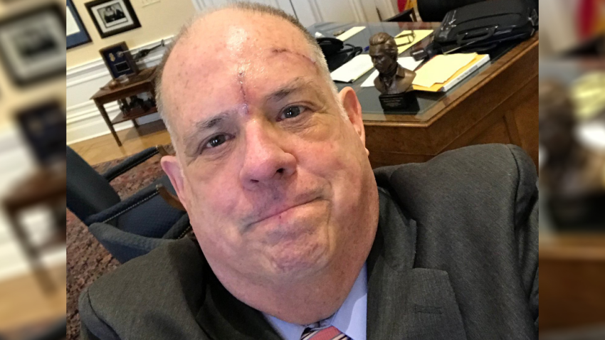 Image result for larry hogan bandages