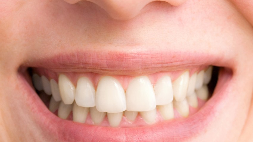 generic smile