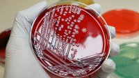 Antibiotic-Resistant Infections Are a ‘Major Global Health Threat' That's Killing Millions, Scientists Say