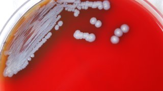 petri plate containing multiple colonies of Gram-negative Burkholderia pseudomallei bacteria.