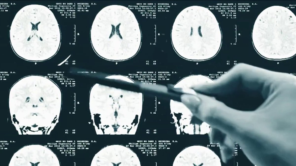 Glioblastoma Awareness Day – NBC4 Washington - Vimarsana News