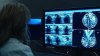 Mammogram Study Could Change Breast Cancer Screenings