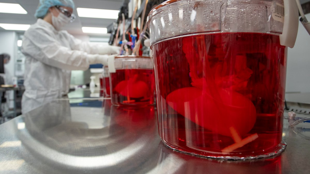 Scientists Seek to Use Pig Livers to Ease Organ Shortage – NBC4 Washington - Vimarsana News