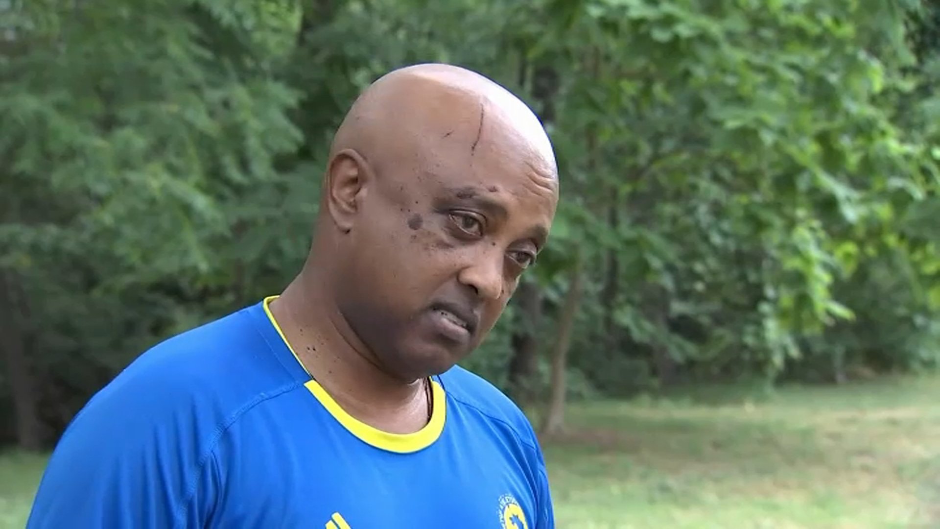 Limo driver beaten, dragged by vehicle in violent carjacking - Vimarsana News