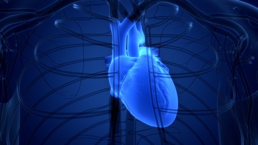 What is cardiac arrest?