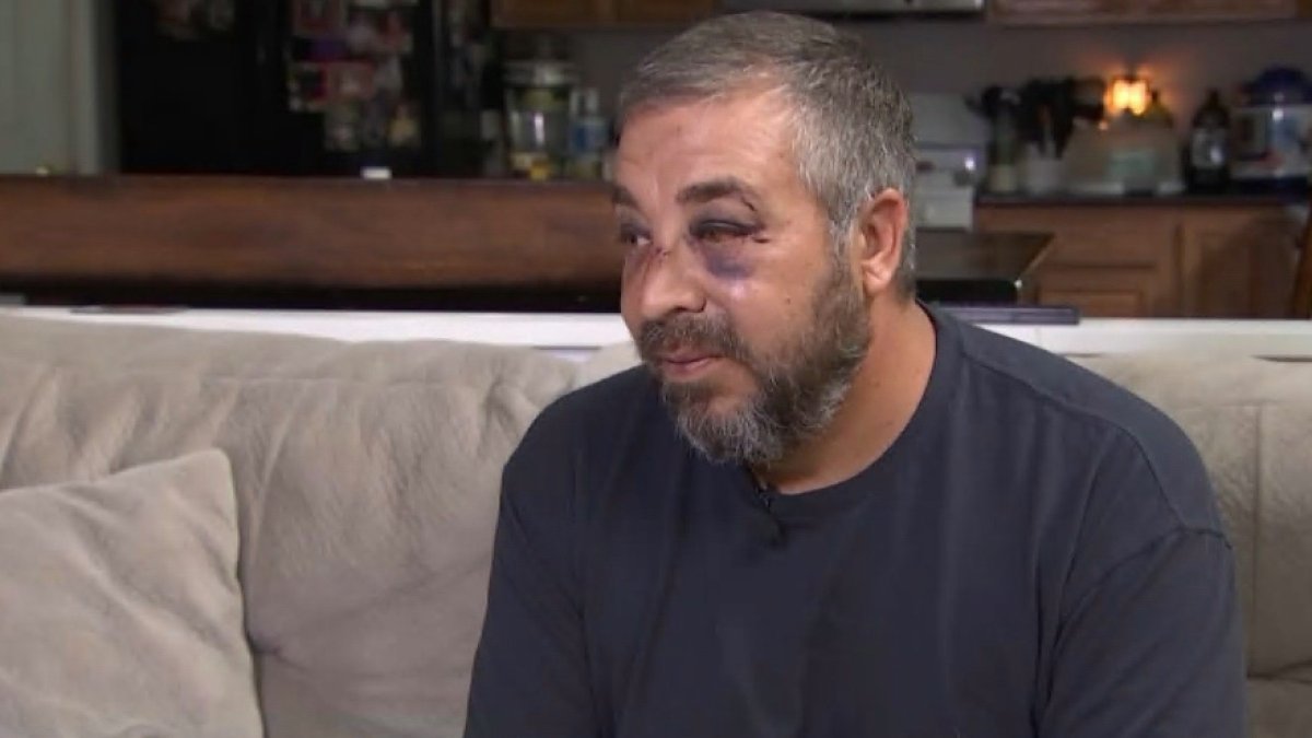 Youth soccer coach recovering from attack by parent in Virginia NBC4