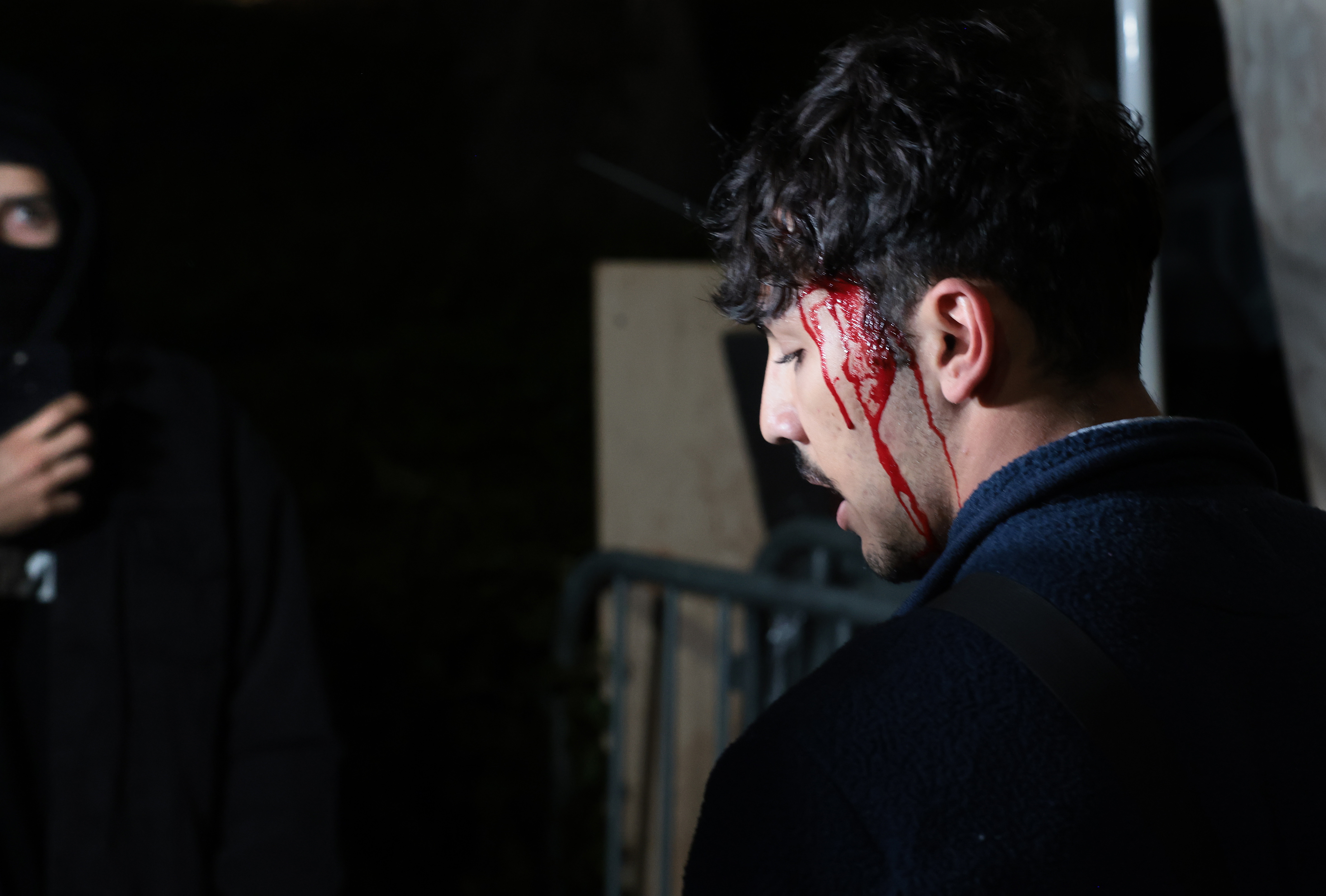 LOS ANGELES, CALIFORNIA – May 1: A Pro-Palestinian protester bleeds from his head after clashing with pro-Israeli supporters encampment at UCLA early Wednesday morning. (Wally Skalij/Los Angeles Times via Getty Images)