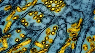 This colorized electron microscope image released by the National Institute of Allergy and Infectious Diseases on March 26, 2024, shows avian influenza A H5N1 virus particles (yellow), grown in Madin-Darby Canine Kidney (MDCK) epithelial cells (blue).