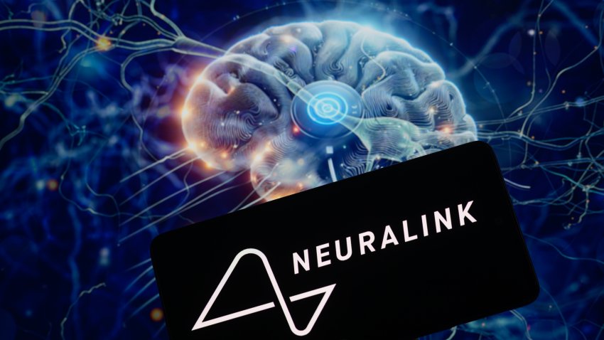 The Neuralink logo is being displayed on a smartphone with a brain chip visible in the background in this photo illustration in Brussels, Belgium, on January 30, 2024. (Photo by Jonathan Raa/NurPhoto via Getty Images)