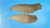First human case of flesh-eating screwworm parasite detected in the U.S.