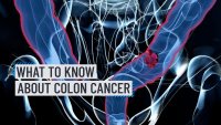 Imagery of colon