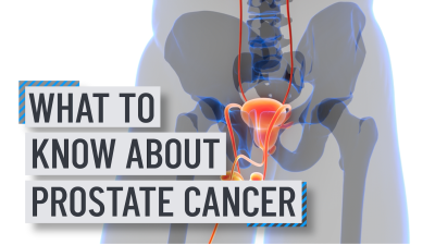 What you need to know about prostate cancer