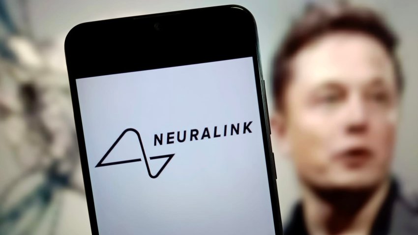 [CNBC] Elon Musk&#8217;s Neuralink filed as &#8216;disadvantaged business&#8217; before being valued at $9 billion