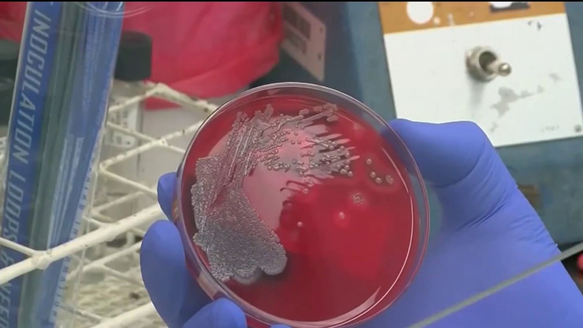 Potomac sewage pipe repairs delayed; tests show bacteria's spread