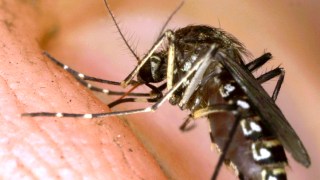 Sentara Treats Man's Chronic Wounds